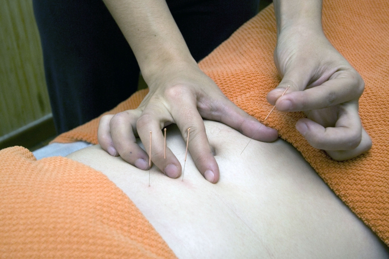 osteopathe-LE THORONET-min_acupuncture-4175625